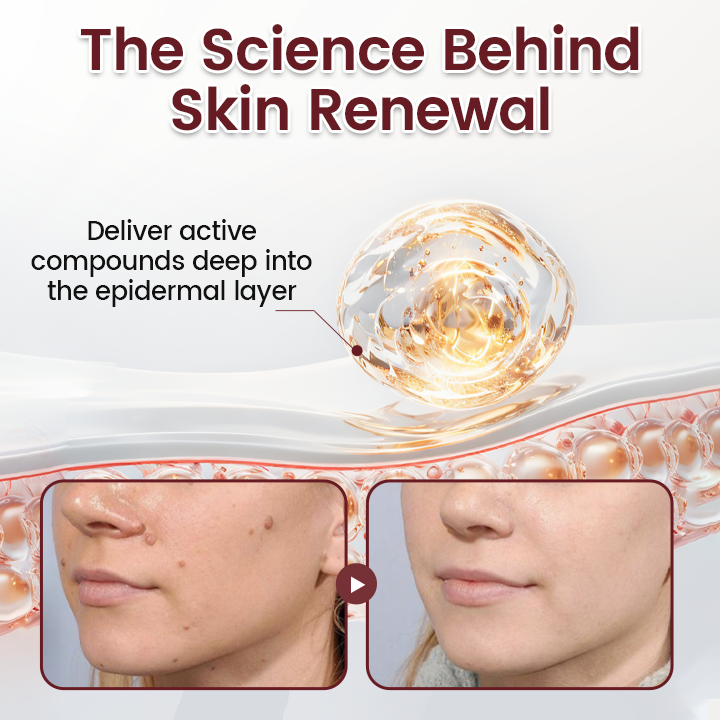 Timilk® BumpAway Gentle Renewal Cream image Timilk® BumpAway Gentle Renewal Cream