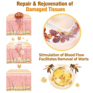 Flysmus® Bee Venom Comprehensive Cream