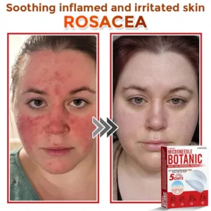 Yunpso™ MicroNeedle Botanic Skin Tag Removal Patch