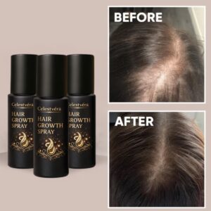 Celestvéra Hair Growth Spray