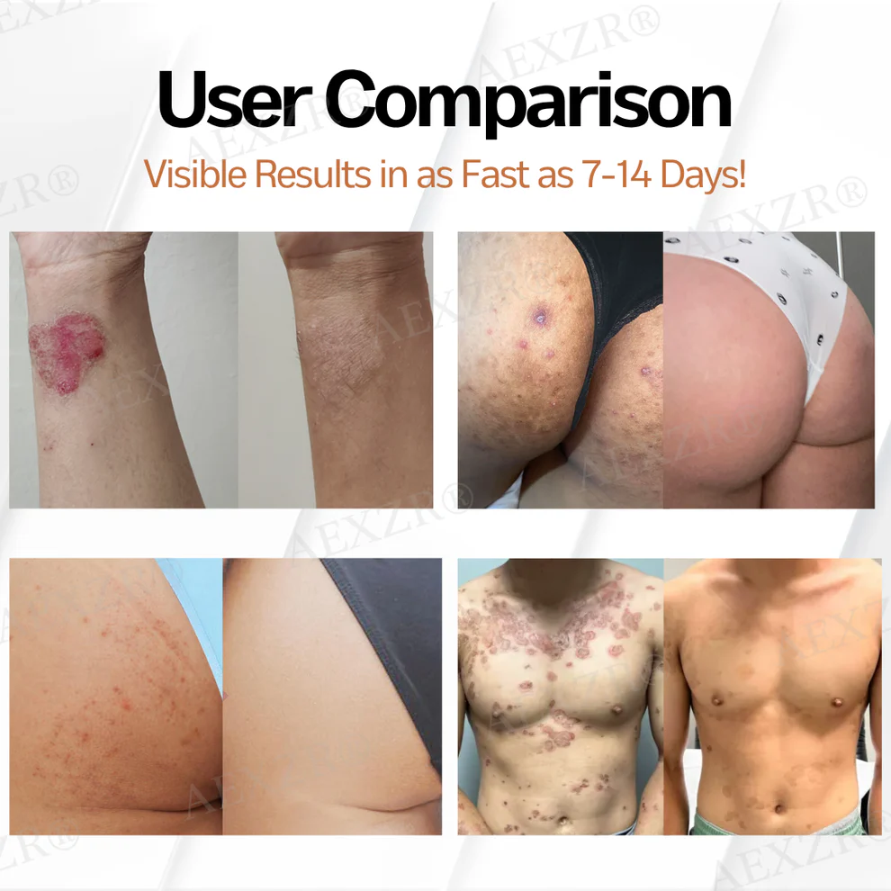 AEXZR® New Zealand Manuka Honey All-in-One Cream image AEXZR® New Zealand Manuka Honey All-in-One Cream