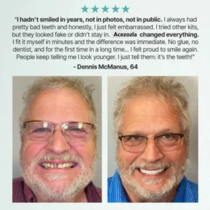 Acezozla™ Custom-Fit Fully Functional Dentures for a More Confident Smile image Acezozla™ Custom-Fit Fully Functional Dentures for a More Confident Smile