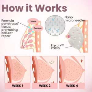 Elycura™ Breast Enhancement Nano Patch