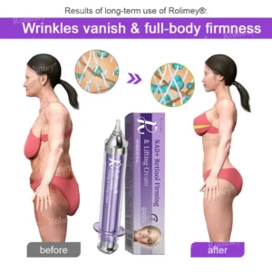 Rolimey® NAD+ Retinol Firming & Lifting Cream