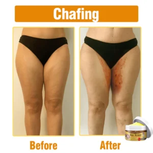 Flysmus® Bee Venom Comprehensive Cream image Flysmus® Bee Venom Comprehensive Cream