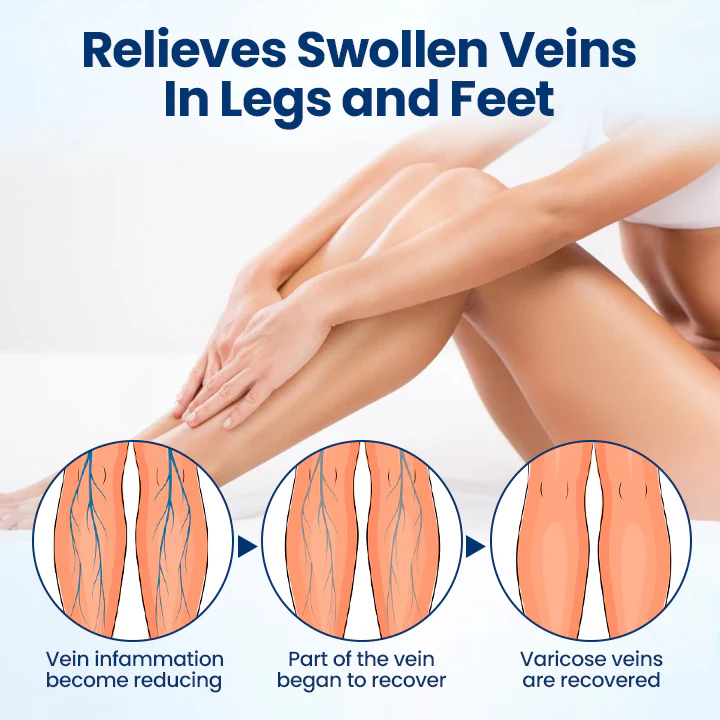 Timilk® VenoRelief Botanical Leg Spray