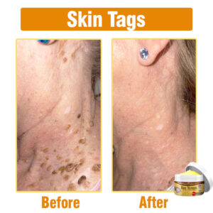 Flysmus® Bee Venom Comprehensive Cream image Flysmus® Bee Venom Comprehensive Cream