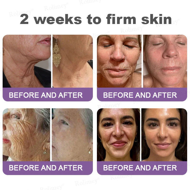 Rolimey® NAD+ Retinol Firming & Lifting Cream