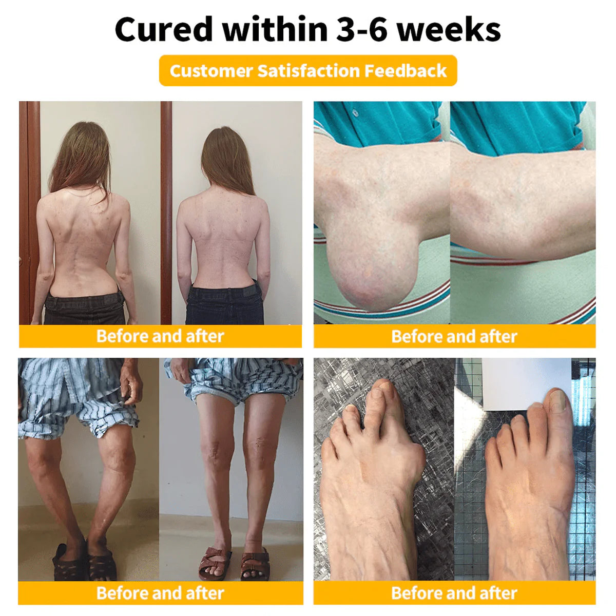 BeeRx BeeThera Bee Venom Pain Relief & Bone Healing Cream