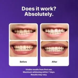 QIAWI Purple Whitening Strips