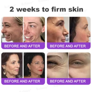 Rolimey® NAD+ Retinol Firming & Lifting Cream