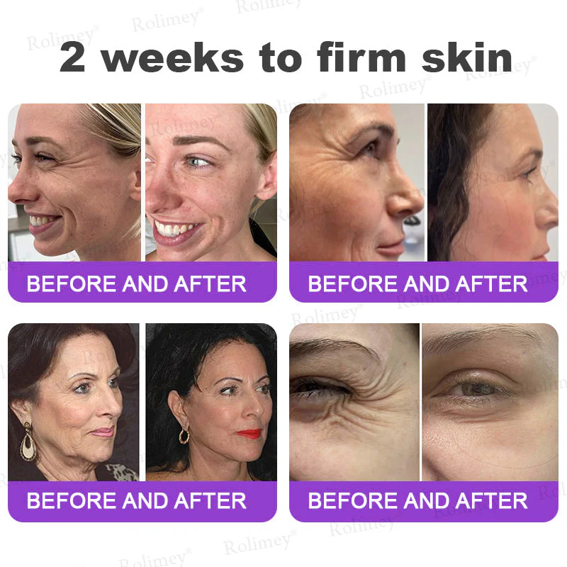 Rolimey® NAD+ Retinol Firming & Lifting Cream