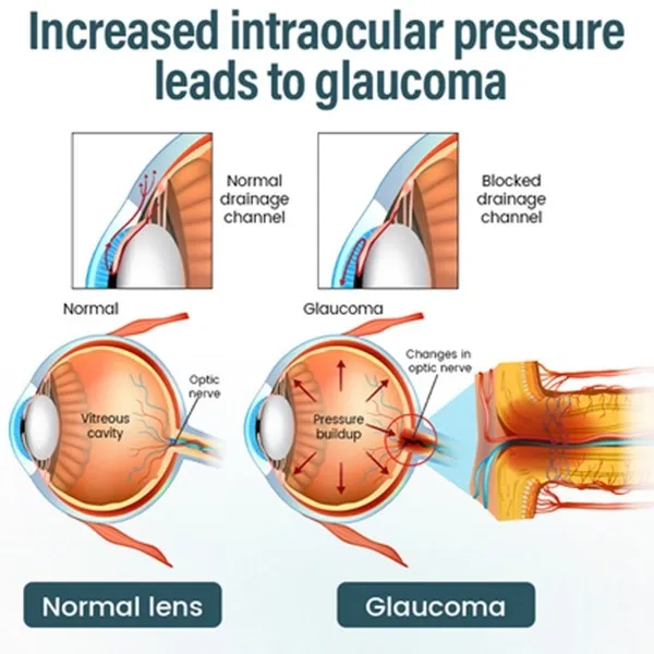 Elycura™ NANO Eye Drop Serum