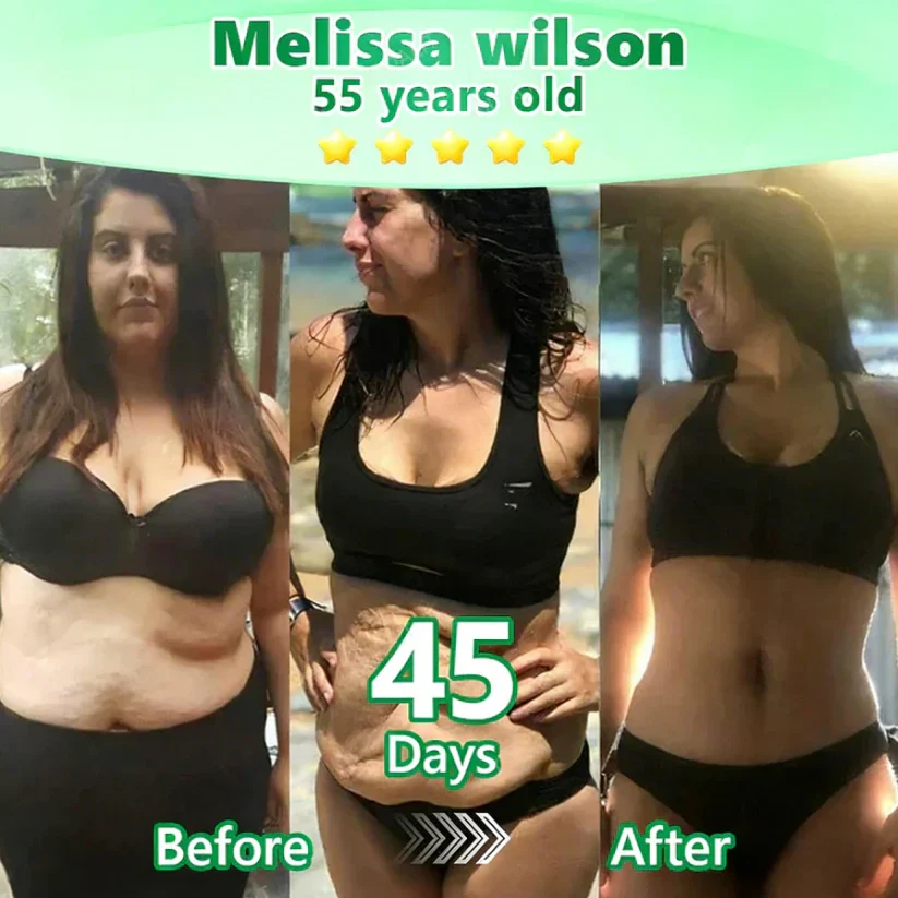 ADAPTISE L-Carnitine × Retinol Nano Microneedle Patch