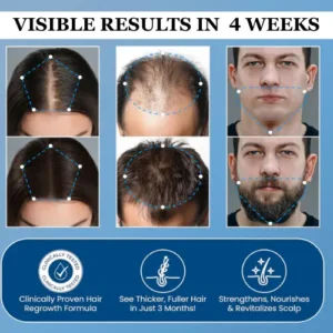 Alisanda® Hair Growth Roll on Serum image Alisanda® Hair Growth Roll on Serum