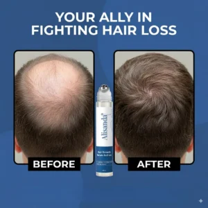 Alisanda® Hair Growth Roll on Serum image Alisanda® Hair Growth Roll on Serum