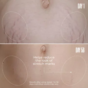 QIAWI® Tighten & Smooth Belly Cream