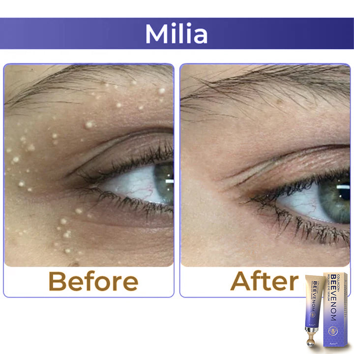 Fysmus® Collagen+ Bee Venom Roller Eye Cream image Fysmus® Collagen+ Bee Venom Roller Eye Cream