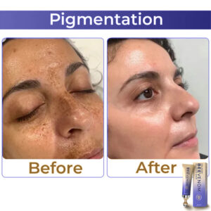 Fysmus® Collagen+ Bee Venom Roller Eye Cream image Fysmus® Collagen+ Bee Venom Roller Eye Cream