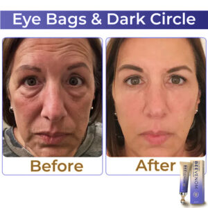 Fysmus® Collagen+ Bee Venom Roller Eye Cream image Fysmus® Collagen+ Bee Venom Roller Eye Cream