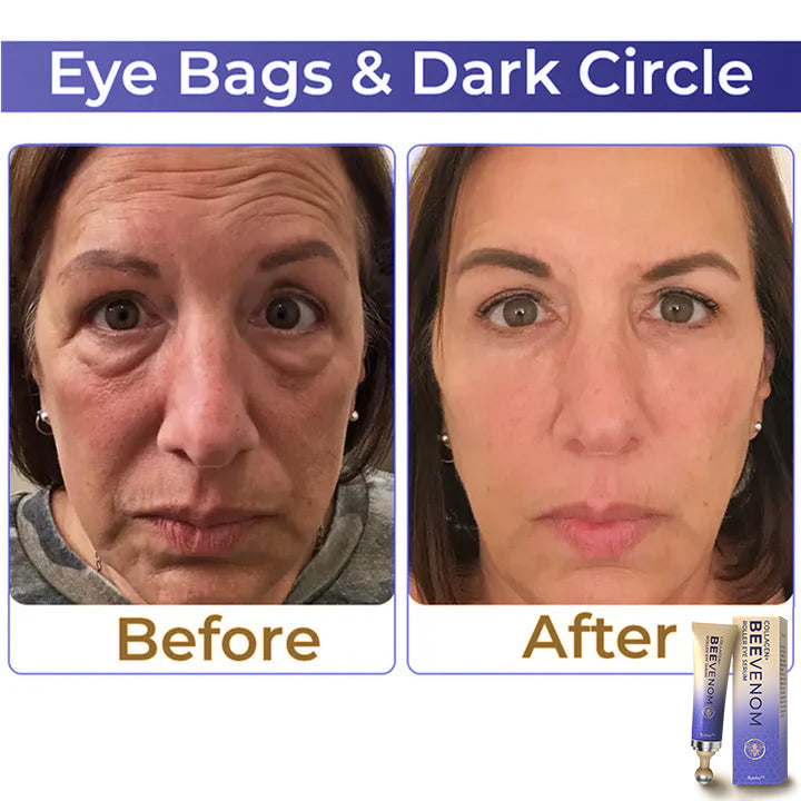 Fysmus® Collagen+ Bee Venom Roller Eye Cream image Fysmus® Collagen+ Bee Venom Roller Eye Cream