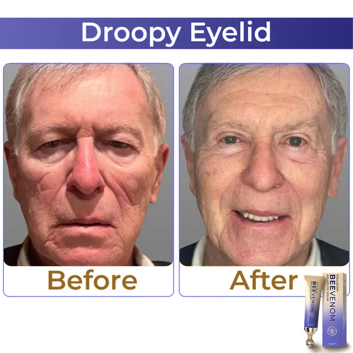 Fysmus® Collagen+ Bee Venom Roller Eye Cream image Fysmus® Collagen+ Bee Venom Roller Eye Cream