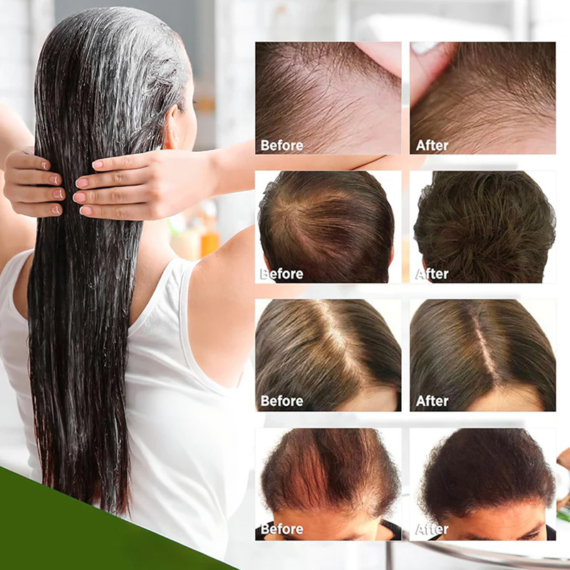 Slimoly® Rosemary Hydrolyzed Keratin Shampoo