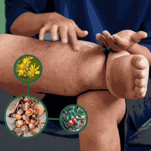 Relieflogix Edeme Relief lotion