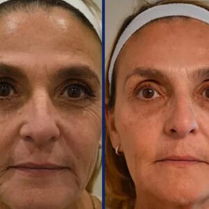 Elycura™ Liquid Solition