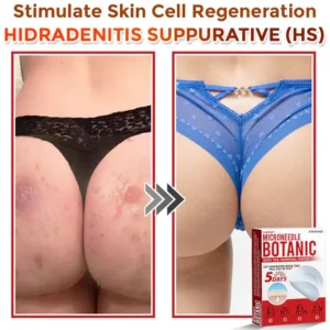 Yunpso™ MicroNeedle Botanic Skin Tag Removal Patch