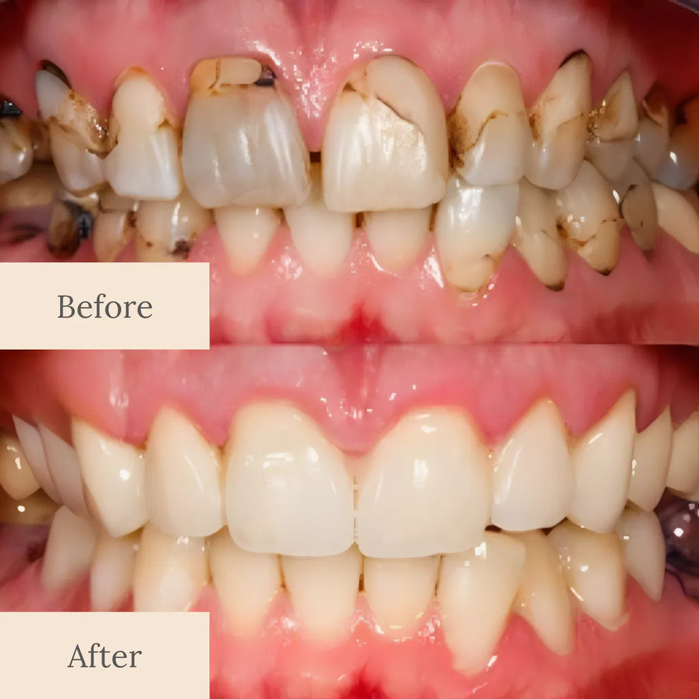 QIAWI® Teeth Armor Drops