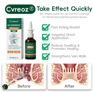 Cvreoz® Fast Hemorrhoid PRO Spray image Cvreoz® Fast Hemorrhoid PRO Spray