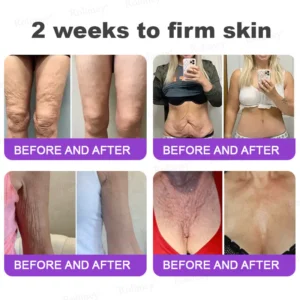 Rolimey® NAD+ Retinol Firming & Lifting Cream