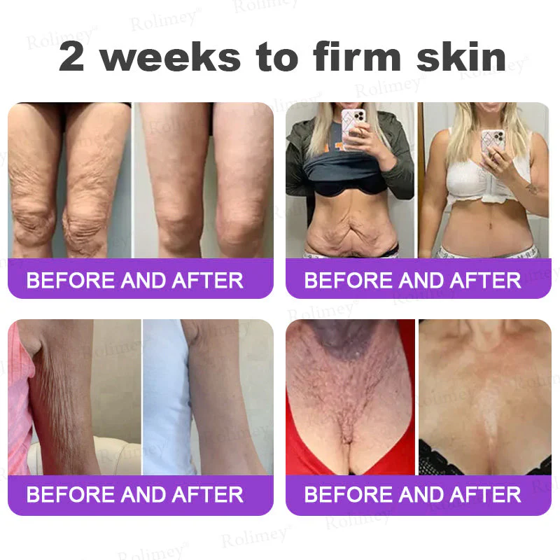 Rolimey® NAD+ Retinol Firming & Lifting Cream