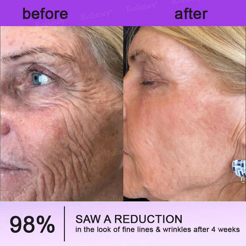 Rolimey® NAD+ Retinol Firming & Lifting Cream