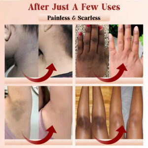 PHANSTA™ Purifying Peeling Gel image PHANSTA™ Purifying Peeling Gel