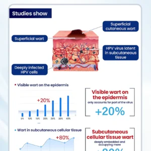 NESLEMY® ChillErase Bump Renewal Spray