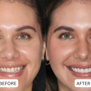 QIAWI® Teeth Armor Drops