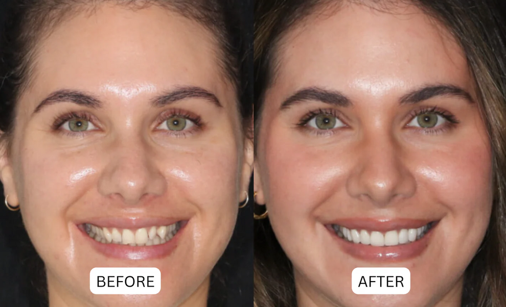 QIAWI® Teeth Armor Drops