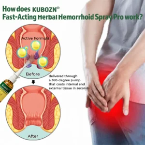 KUBOZN® Fast-Acting Herbal Hemorrhoid Spray Pro image KUBOZN® Fast-Acting Herbal Hemorrhoid Spray Pro
