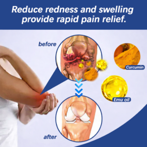 NEWYUO™ Turmeric + Emu Oil Arthritis Relief Massage Gel