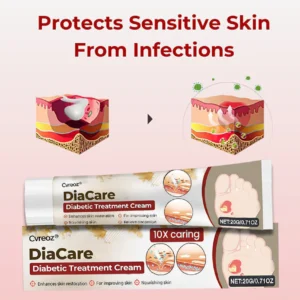 CVREOZ® DiaCare Diabetic Treatment Cream