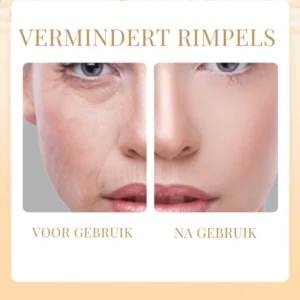 Skinova™ Sadoer Rejuvenating Collagen Face Masks