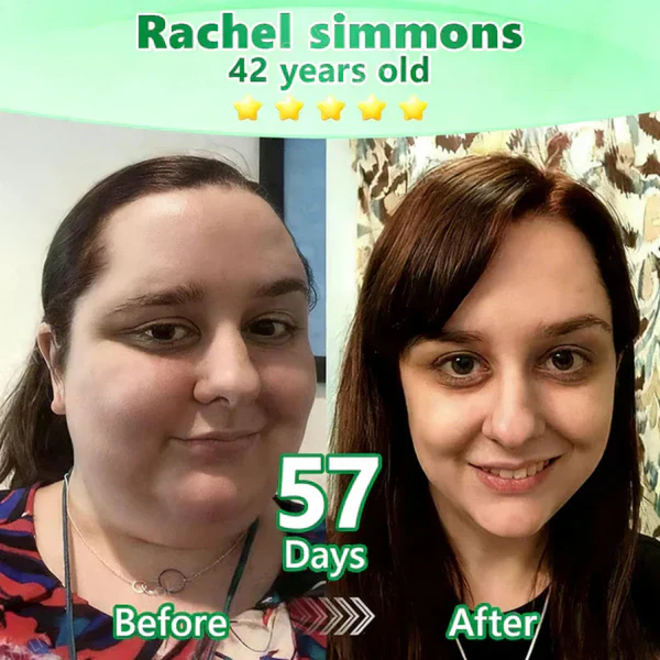 ADAPTISE L-Carnitine × Retinol Nano Microneedle Patch