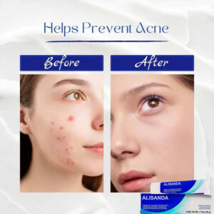 Alisanda Ultimate skincare formula + hyaluronic acid - Suitable for all ages