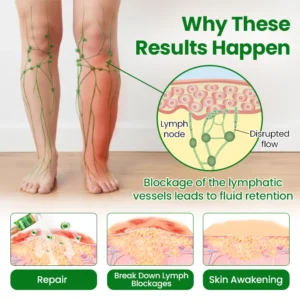 LAOZIK™ VenoSoothe Leg Relief Spray