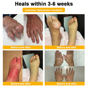 LOVILDS™ Bee Venom Pain-Relief Bone Healing Cream