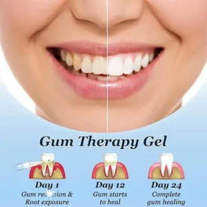 Mullend™: Stop Gum Recession and Bleeding Without Painful Surgery image Mullend™: Stop Gum Recession and Bleeding Without Painful Surgery
