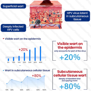 Healrize® WartLock Cryo-Recovery Cooling Spray