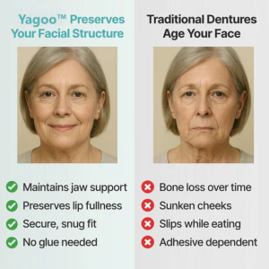 Yagoo™ Custom-Fit Functional Dentures So Special